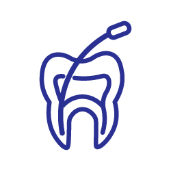 Endodoncia